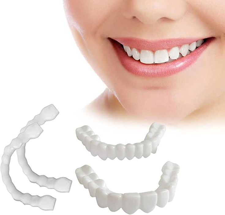 Snap On Smile