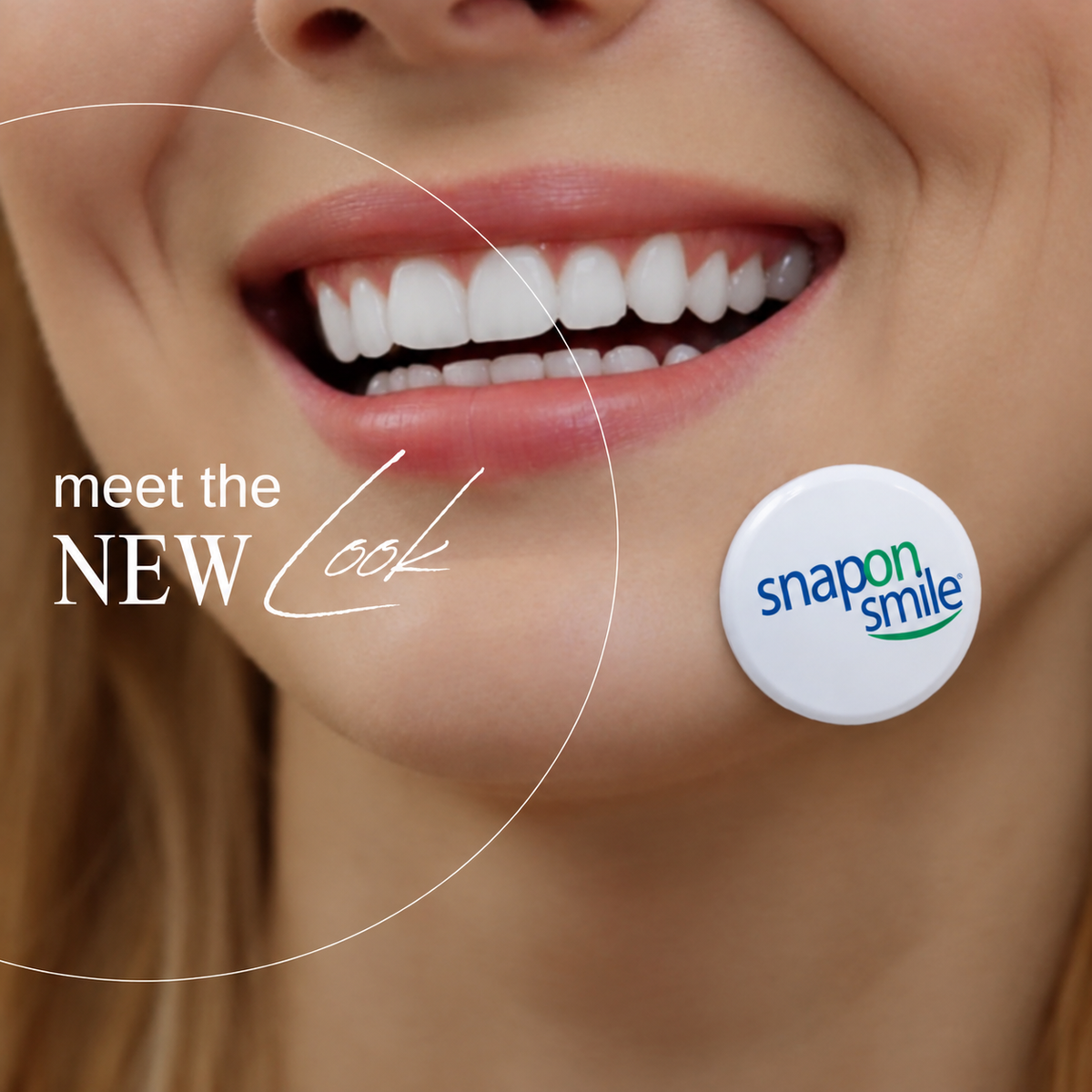 Snap On Smile