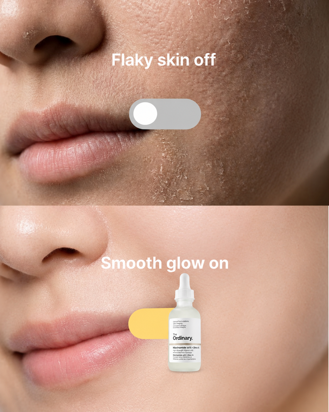 Niacinamide 10% + Zinc 1% Face Serum