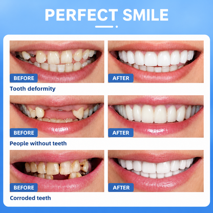 Snap On Smile
